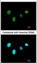 RFX6 Antibody in Immunocytochemistry (ICC/IF)