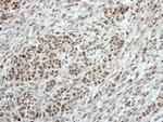 T-bet Polyclonal Antibody