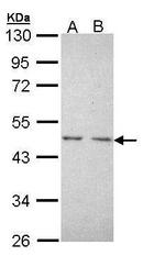 TR2 Polyclonal Antibody