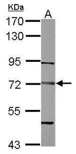 DTNB Antibody in Western Blot (WB)