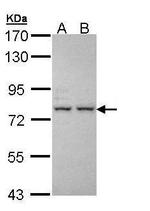 ALS Polyclonal Antibody