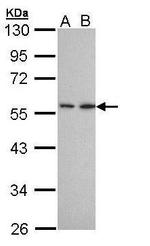 DPP2 Polyclonal Antibody