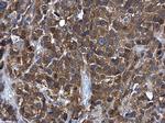 GSTM5 Antibody in Immunohistochemistry (Paraffin) (IHC (P))