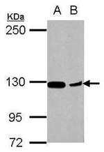 CHL1 Antibody in Western Blot (WB)
