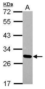 DLX1 Polyclonal Antibody