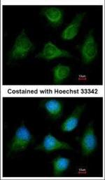 CACNB1 Polyclonal Antibody