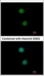 DNA ligase IV Polyclonal Antibody