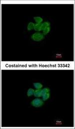 RAP2A Polyclonal Antibody
