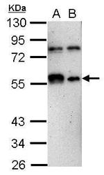 KLF12 Antibody in Western Blot (WB)