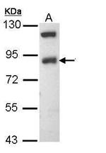 SCNN1B Polyclonal Antibody