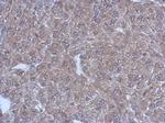 Bestrophin 1 Polyclonal Antibody