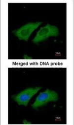 STK33 Polyclonal Antibody