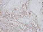 STK33 Antibody in Immunohistochemistry (Paraffin) (IHC (P))