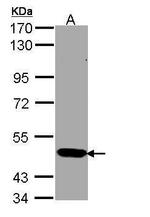 STK33 Antibody in Western Blot (WB)