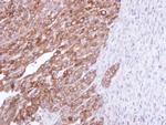 FDFT1 Polyclonal Antibody