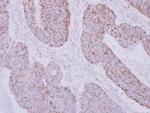 PSTPIP2 Polyclonal Antibody