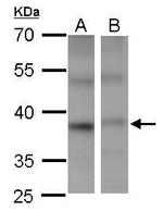 PSTPIP2 Antibody in Western Blot (WB)