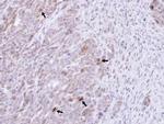 GRB14 Antibody in Immunohistochemistry (Paraffin) (IHC (P))