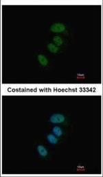 XPD Polyclonal Antibody