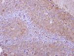 PPP6C Polyclonal Antibody
