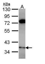 PPP6C Antibody in Western Blot (WB)