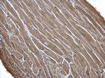 Creatine Kinase MM Polyclonal Antibody