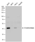 Creatine Kinase MM Antibody in Western Blot (WB)