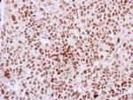 DKC1 Antibody in Immunohistochemistry (Paraffin) (IHC (P))