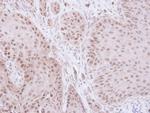 GTF2E2 Polyclonal Antibody