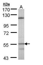 CYP4B1 Polyclonal Antibody