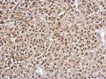 FOXO4 Antibody in Immunohistochemistry (Paraffin) (IHC (P))