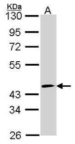 FOXO4 Antibody in Western Blot (WB)