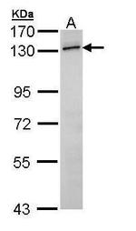RNF20 Polyclonal Antibody