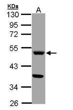 TPH1 Antibody in Western Blot (WB)