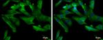 TPH1 Antibody in Immunocytochemistry (ICC/IF)