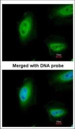 p73 Polyclonal Antibody