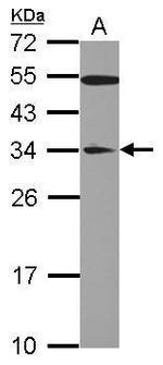 GAS41 Polyclonal Antibody