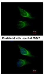 SNAP23 Antibody in Immunocytochemistry (ICC/IF)