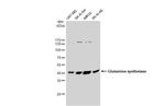Glutamine Synthetase Antibody in Western Blot (WB)