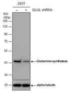 Glutamine Synthetase Antibody in Western Blot (WB)