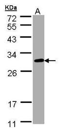 CHIC2 Antibody in Western Blot (WB)