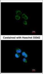 HIBCH Polyclonal Antibody