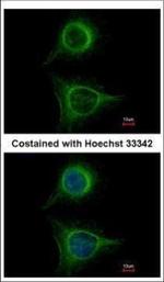 SBDS Antibody in Immunocytochemistry (ICC/IF)