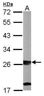 SBDS Antibody in Western Blot (WB)