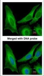 SAR1B Polyclonal Antibody
