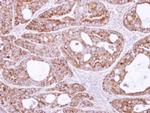 SAR1B Antibody in Immunohistochemistry (Paraffin) (IHC (P))