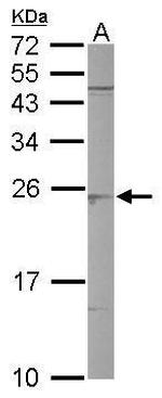 SAR1B Antibody in Western Blot (WB)