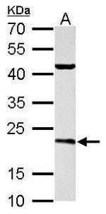 SAR1B Antibody in Western Blot (WB)