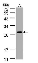 SAR1B Antibody in Western Blot (WB)