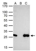 EN2 Antibody in Immunoprecipitation (IP)